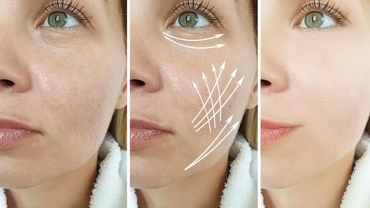 Can One Treatment Really Tackle More Than One Skin Concern Herne?