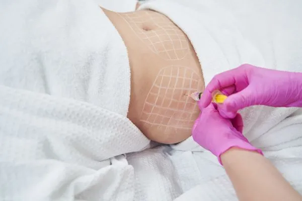 image of fat dissolving injections on love handles to help combat weight gain Herne