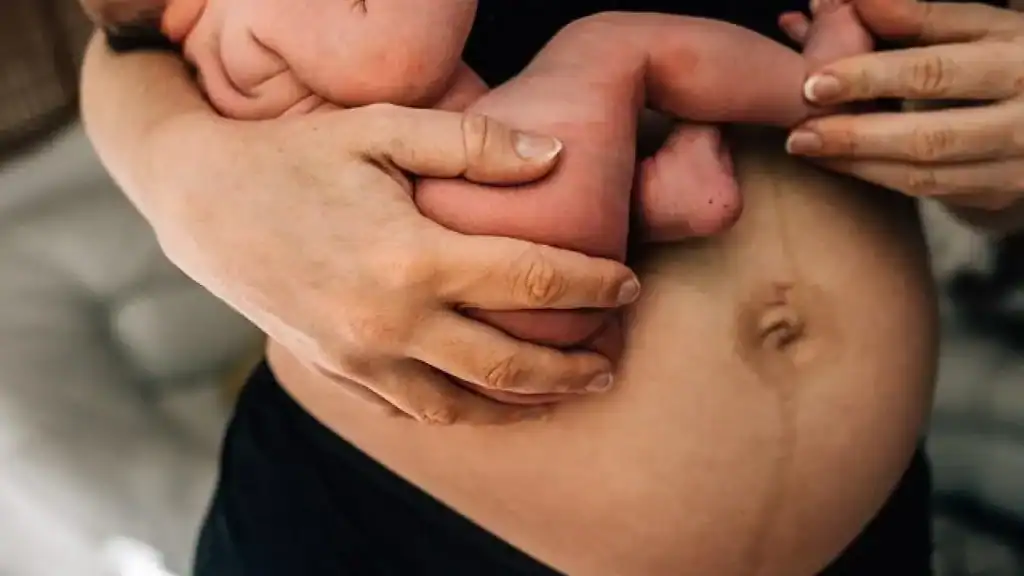 Why Is My Stomach Still Big After Pregnancy Herne?
